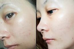 gluta drip dubai|Best Gluta Drip in Dubai .